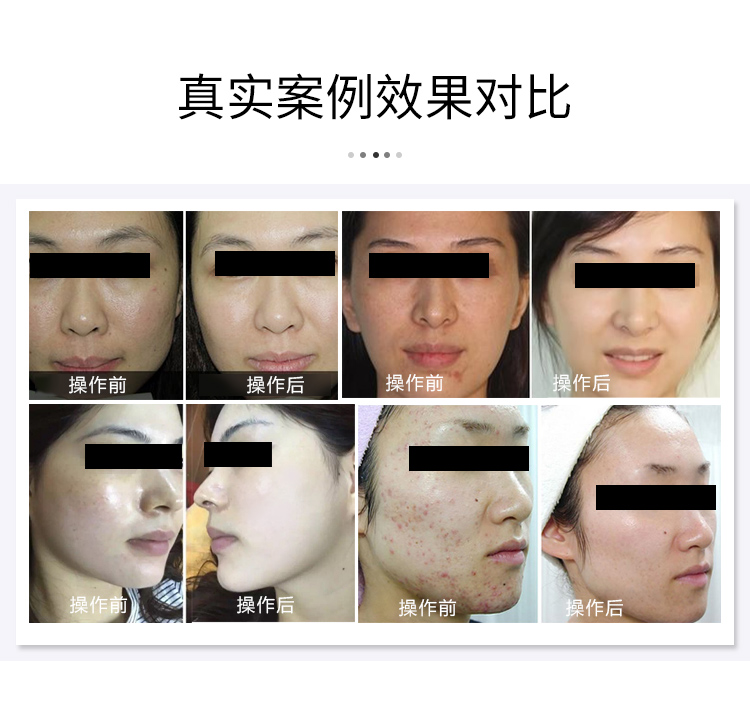 折叠式光谱仪.jpg 红蓝光美容仪器作用